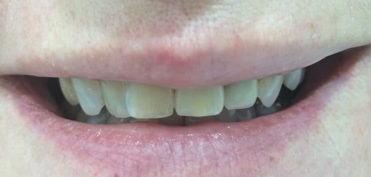 After: cosmetic dentistry