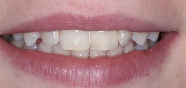 After: cosmetic dentistry