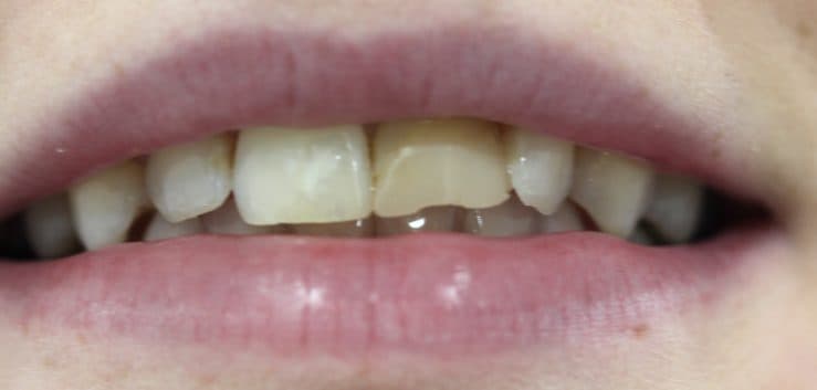 Before: cosmetic dentistry