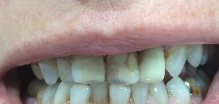 Before: cosmetic dentistry
